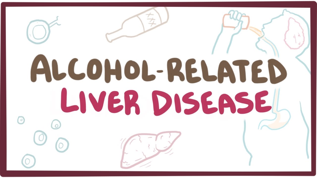 ALCOHOLIC LIVER DISEASE – BASIC FACTS Image